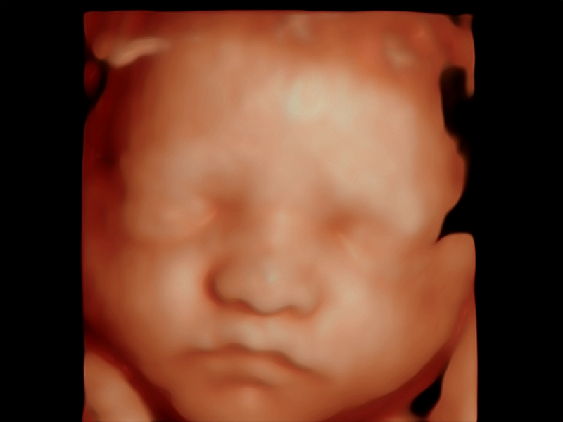 Ecografía original antes de la visualización