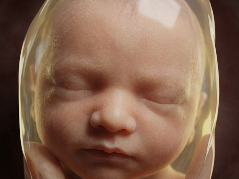 Visualización hiperrealista generada para comunicación clínica